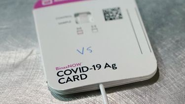 EEUU autoriza dos pruebas caseras de coronavirus