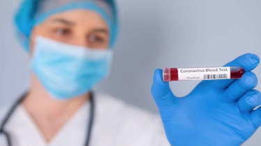 el cuadro que explica por que el coronavirus es tan peligroso