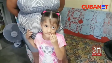 nina cubana esta en peligro de perder la vision de uno de sus ojos debido a la falta de un tratamiento efectivo  en la isla