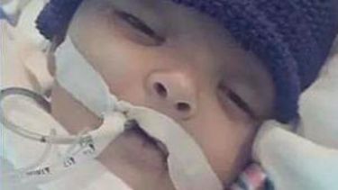 americateve | El menor estaba hospitalizado en el Hospital de Niños de Miami desde el pasado lunes