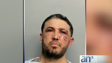 balean a un hombre en su apartamento en hialeah