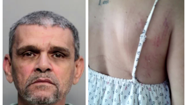 en corte un hombre de origen cubano acusado de golpear y tratar de estrangular a su esposa en hialeah