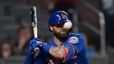 mets: pillar con multiples fracturas nasales por pelotazo (video)