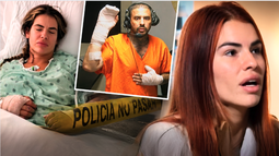 cubana de miami sobrevive a 34 punaladas de su expareja: pense que iba a morir