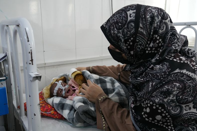 Nagina, de 22 años, atiende a su hijo en la sala de desnutrición del Hospital Infantil Indira Gandhi, el lunes 12 de octubre de 2026, en Kabul, Afganistán. (AP Foto/Siddiqullah Alizai)