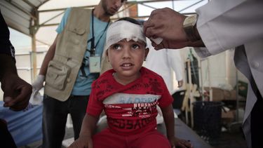 americateve | Un ni&ntilde;o palestino es atendido en el hospital kuwait&iacute; de Rafa por lesiones sufridas durante un ataque del ej&eacute;rcito israel&iacute; en la Franja de Gaza el domingo 3 de agosto de 2014. (Foto de AP/Khalil Hamra)