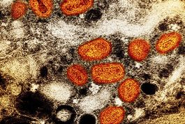 ¿la viruela simica es una enfermedad de transmision sexual?