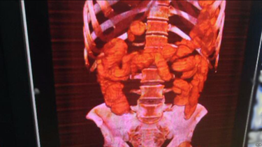 las escalofriantes fotos de una mula del narco atrapada en cuba