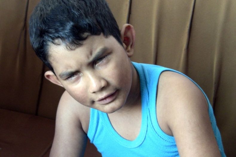 niño ciego negligencia medica.jpg