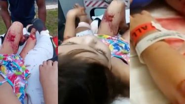 desgarradoras imagenes de una madre y su hija atacadas por dos perros en miami