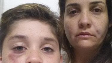 americateve | Jorge Eduardo García, de sólo 12 años de edad y su madre fueron agredidos fuertemente en Miami.