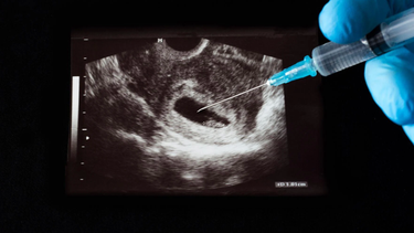bajo fuego la medida que limitaria el aborto