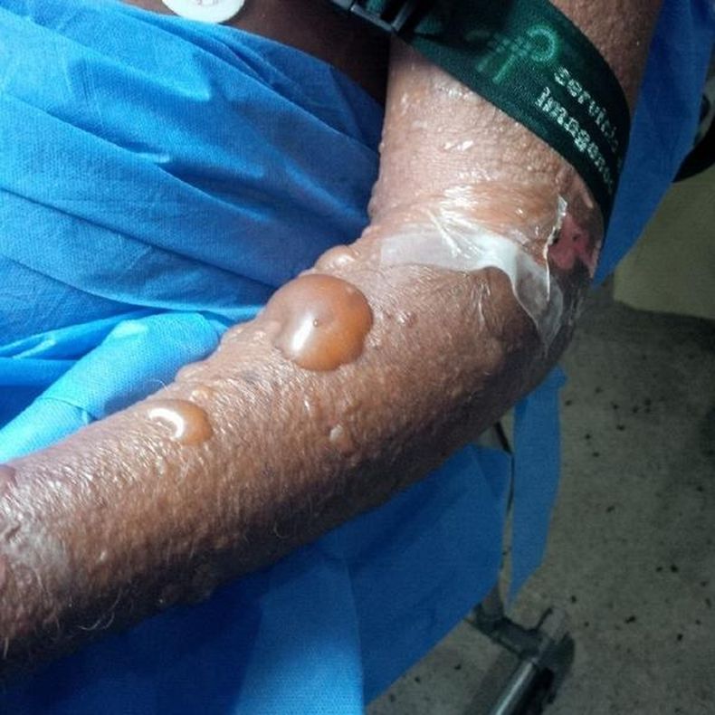 Frente a la extraña enfermedad que ha cobrado más de una decena de vidas en Venezuela.  La ministra de Salud dijo que no había "enfermedades hemorrágicas ni raras"
