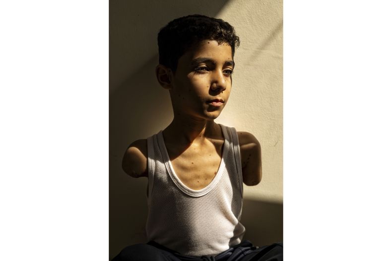 Esta imagen, distribuida por World Press Photo y tomada por Samar Abu Elouf para The New York Times, ganó el premio World Press Photo y muestra a Mahmoud Ajjour (9), que resultó herido en un ataque israelí en la Ciudad de Gaza en marzo de 2024 y recibió atención y atención médica en Doha, Qatar, el 28 de junio de 2024. (Samar Abu Elouf para The New York Times/World Press Photo vía AP)