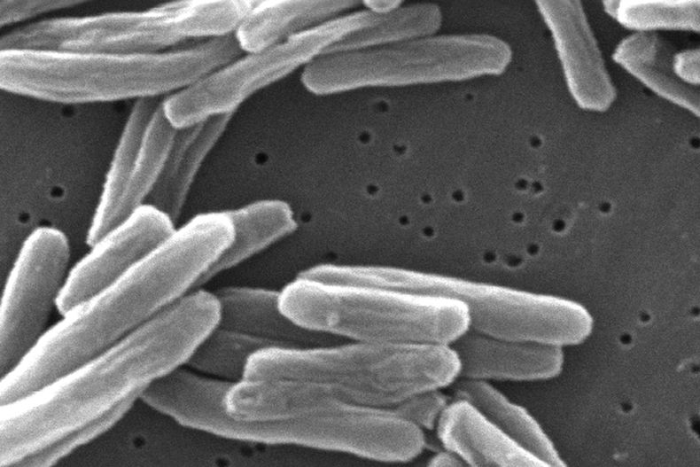 Esta imagen de microscopio de 2006 proporcionada por los Centros para el Control y la Prevención de Enfermedades de Estados Unidos muestra la bacteria mycobacterium tuberculosis, que causa la enfermedad de tuberculosis. (Janice Carr/CDC vía AP)