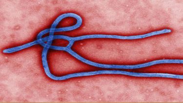 FALSA ALARMA EN MIAMI: DIO NEGATIVO PRUEBA DE EBOLA