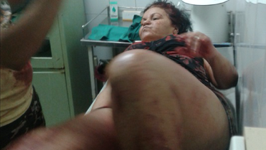 cuba: madre acuchilla a hija de 17 anos para que no emigre a eeuu