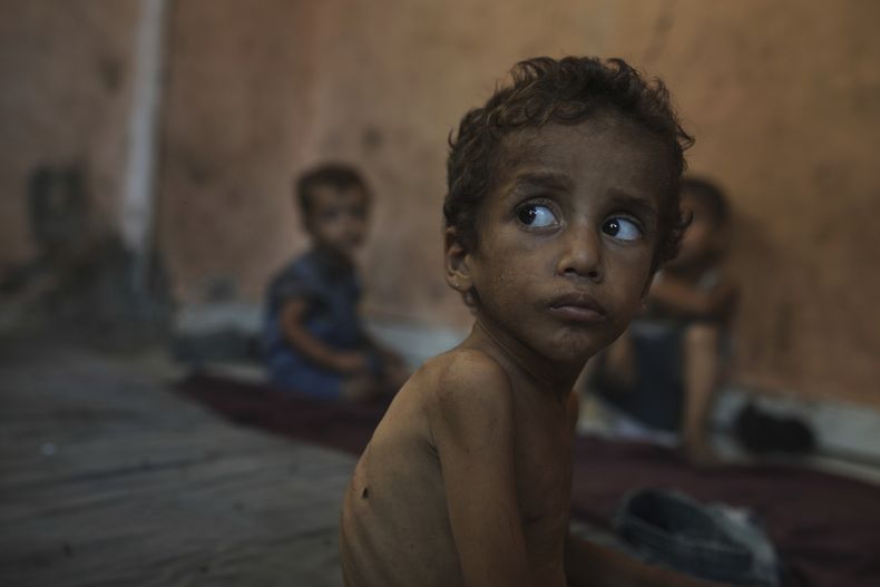 Yazan Abu Ful, un niño de 2 años que padece desnutrición, mira a su alrededor el miércoles 23 de julio de 2025 en el campamento de refugiados Shati, en Ciudad de Gaza. (AP Foto/Jehad Alshrafi)