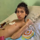 Fallece Yordanis Nieves Méndez, joven cubano de 19 años tras dos años de sufrimiento