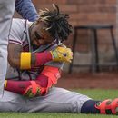 El venezolano Ronald Acuña Jr., de los Bravos de Atlanta, se sienta luego de recibir un pelotazo en el juego del lunes 1 de mayo de 2023, ante los Mets de Nueva York (AP Foto/Seth Wenig)