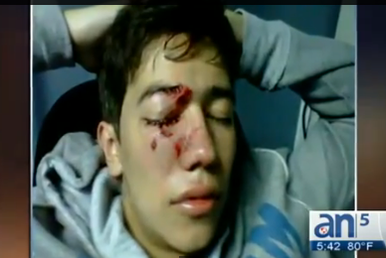 Estudiantes y policías heridos es el resultado de las protestas contra el gobierno de Nicolás maduro que se han multiplicado en toda Venezuela. Los manifestantes acusan a la guardia nacional bolivariana de disolver las marchas a balazos.