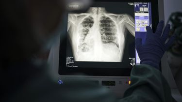 mortal el impacto del repunte de covid-19 en los mayores
