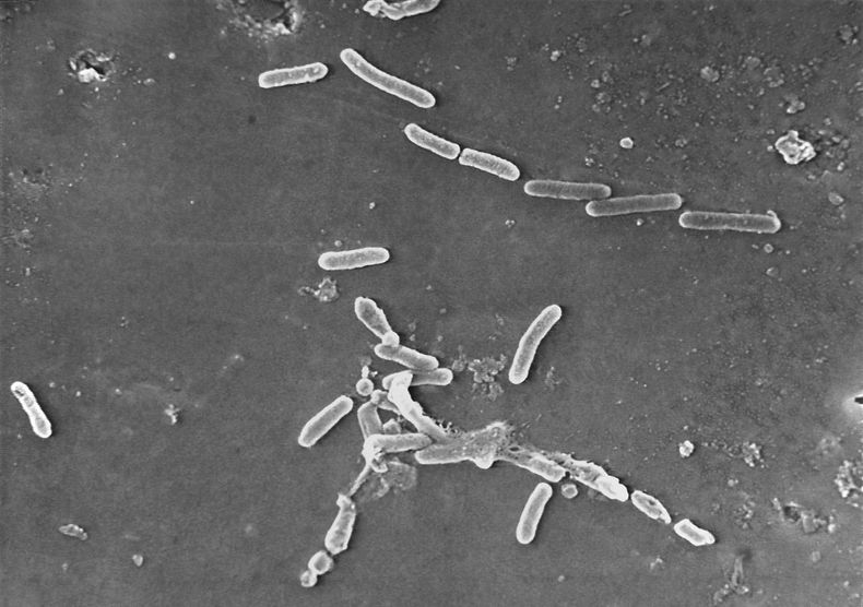 Esta imagen de microscopio electrónico proporcionada por los Centros para el Control y la Prevención de Enfermedades de EE.UU. muestra la bacteria Pseudomonas aeruginosa. (Janice Haney Carr/CDC vía AP, Archivo)