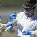Coronavirus: Por ahora pruebas caseras no son buena idea