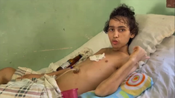 fallece yordanis nieves mendez, joven cubano de 19 anos tras dos anos de sufrimiento