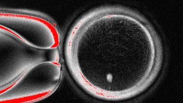 Foto sin fecha, suministrada por el Laboratorio Mitalipov Laboratory en la Universidad de Salud y Ciencia de Oregon, que muestra una imagen microscópica de un óvulo humano que contiene un núcleo tomado de una célula de piel. (Laboratorio Mitalipov via AP)
