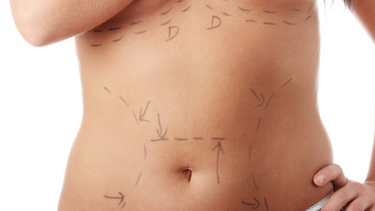 cirugias esteticas y sus riesgos para la salud