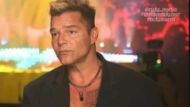 ¿ricky martin se hizo algo en la cara? sus fans estan en shock