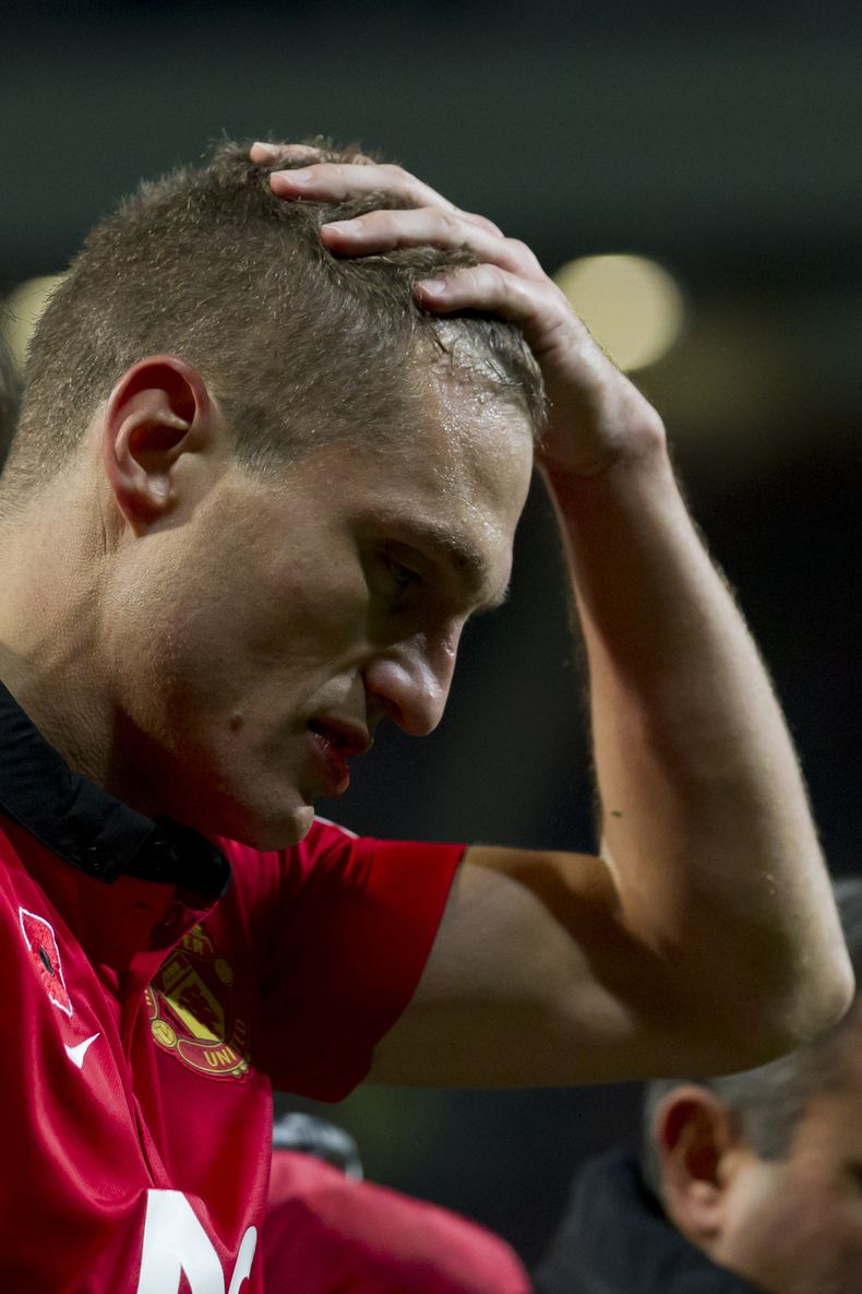 El capit&aacute;n de Manchester United Nemanja Vidic se toma la cabeza al salir del terreno de juego tras sufrir una conmoci&oacute;n cerebral en un partido contra Arsenal, luego de chocar con su propio arquero David de Gea, el 10 de noviembre del 2013 en