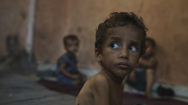 Yazan Abu Ful, un niño de 2 años que padece desnutrición, mira a su alrededor el miércoles 23 de julio de 2025 en el campamento de refugiados Shati, en Ciudad de Gaza. (AP Foto/Jehad Alshrafi)
