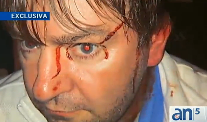 Bomberos de Hialeah rechazan acusaciones de que uno de sus miembros participo en una brutal golpiza a una pareja de Miami.