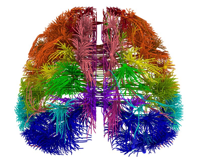 Esta imagen proporcionada por el Instituto Allen de Ciencia Cerebral el 28 de marzo de 2014 muestra una imagen de conexciones que se originan en distintas &aacute;reas corticales del cerebro de los ratones. La investigaci&oacute;n publicada el mi&eacute;r