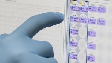 Autorizan en EEUU análisis de sangre experimental para zika