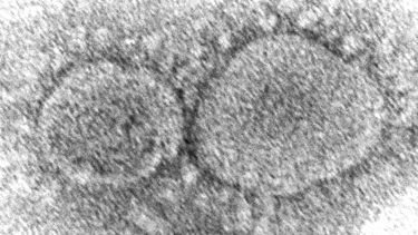 AP Explica: Origen del COVID-19 sigue siendo un misterio