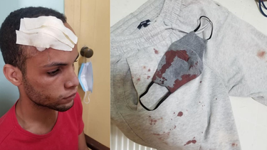 tras horas de maltrato psicologico a manos de la seguridad activista termina auto agrediendose