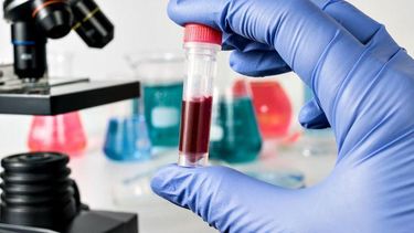 una mujer se curo del vih gracias a un tratamiento novedoso con sangre de cordon umbilical
