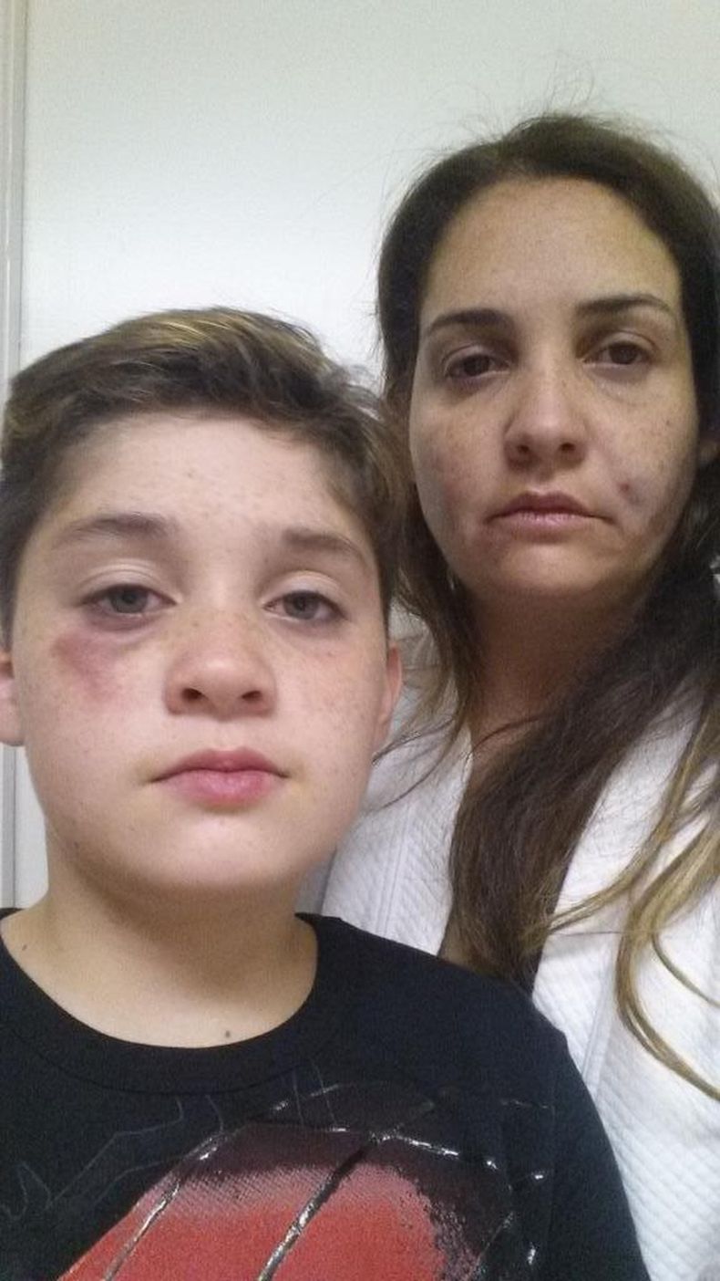 Jorge Eduardo García, de sólo 12 años de edad y su madre fueron agredidos fuertemente en Miami.