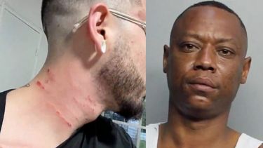 miami: un joven de 24 anos aseguro que fue victima de una golpiza por ser gay