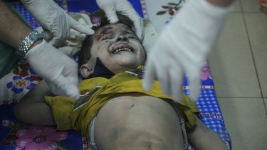 Un niño palestino herido tras un bombardeo israelí es atendido en el hospital en Deir al-Balah, al sur de la Franja de Gaza, el 17 de octubre de 2023. (AP Foto/Hatem Moussa)