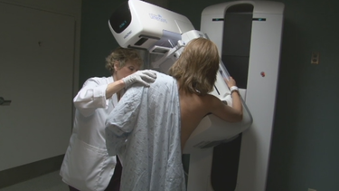 edad para comenzar hacerse la mamografia es motivo de diferencia