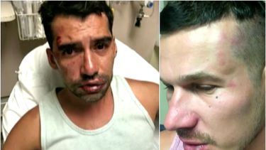 cuatro jovenes le propinan una brutal golpiza a una pareja gay en south beach