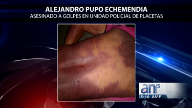 denuncian muerte de cubano por golpiza policial en placetas