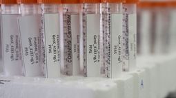Tubos con sustancias químicas eternas, conocidas como PFAS, en un laboratorio de la Agencia de Protección Ambiental en Cincinnati el 10 de abril del 2024. (AP foto/Joshua A. Bickel)
