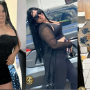 Tragedia en Miami: Madre cubana pierde la vida tras una cirugía estética.. sus dos hijos quedaron en Cuba