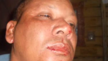 americateve | Ya no te dan golpecitos, te dan goles para matar!". La entrevista de Jose Luis Ferrer