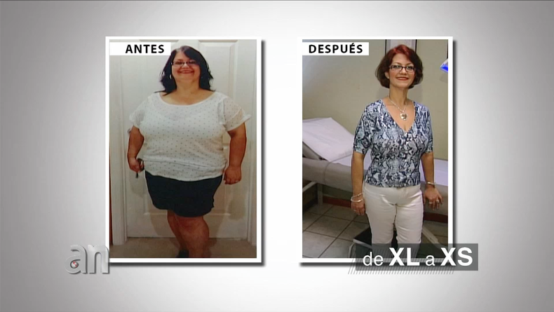 XS XL